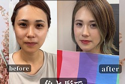 AIを使ったお顔の診断